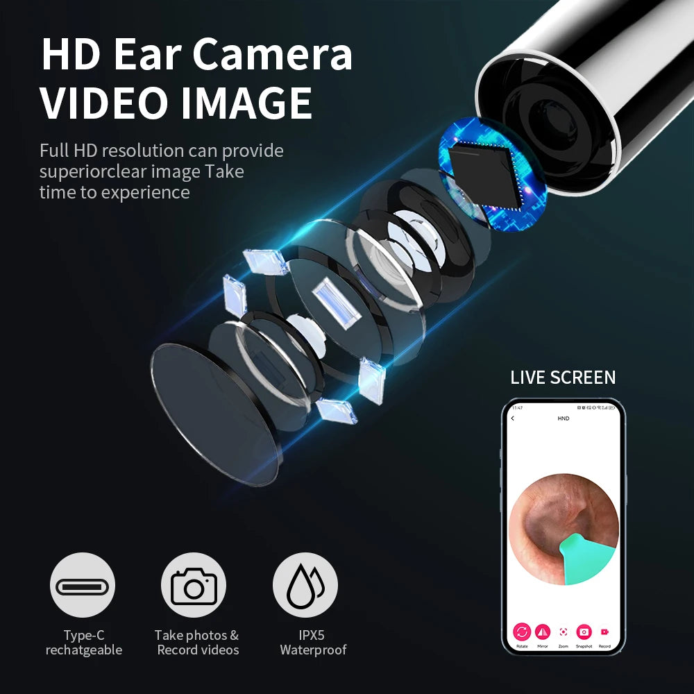 Revolutionary Ear Cleaning Set with HD Camera: Ultimate Otoscope and USB-C Endoscope for Effortless Wax Removal